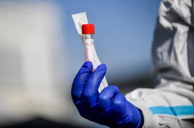 Імунолог сказав, коли епідемія коронавірусу в Україні повинна піти на спад