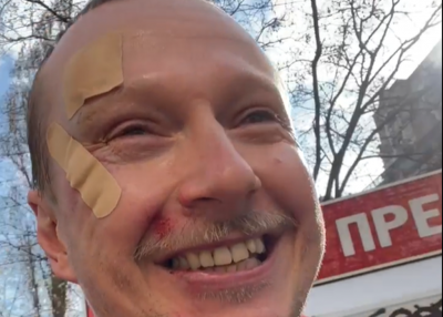 У центрі Києва побили відомого телеведучого Майкла Щура – відео