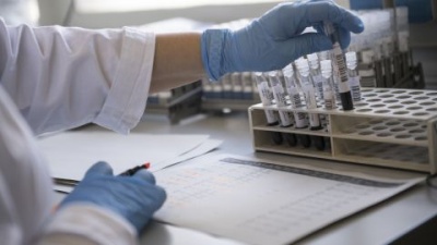 Медик розвінчала страшилку про індійський штам коронавірусу: чи загрожує Україні «чорний грибок»