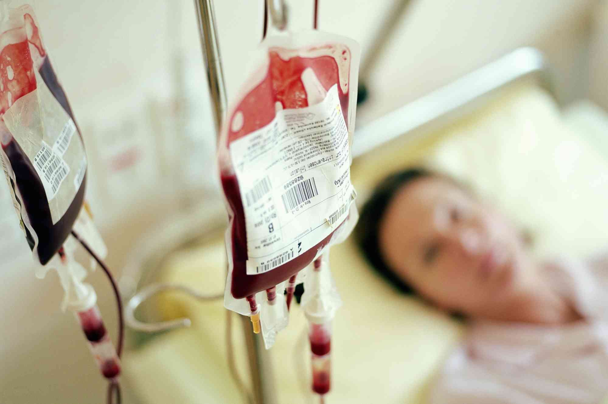 Методи чищення крові який краще вибрати