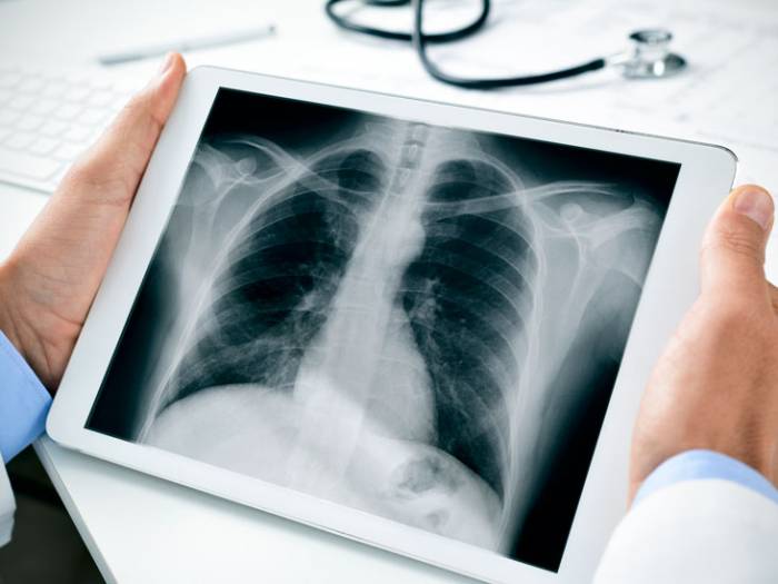 Ефективна доза та інші секрети рентгенографії
