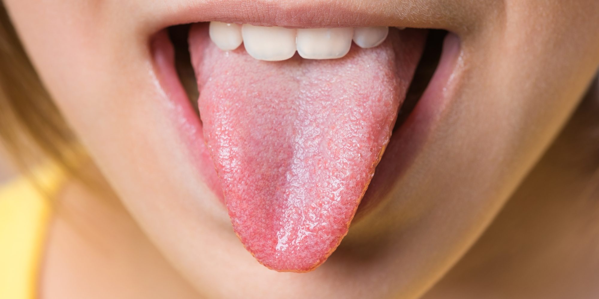 Білий наліт у роті норма чи відхилення