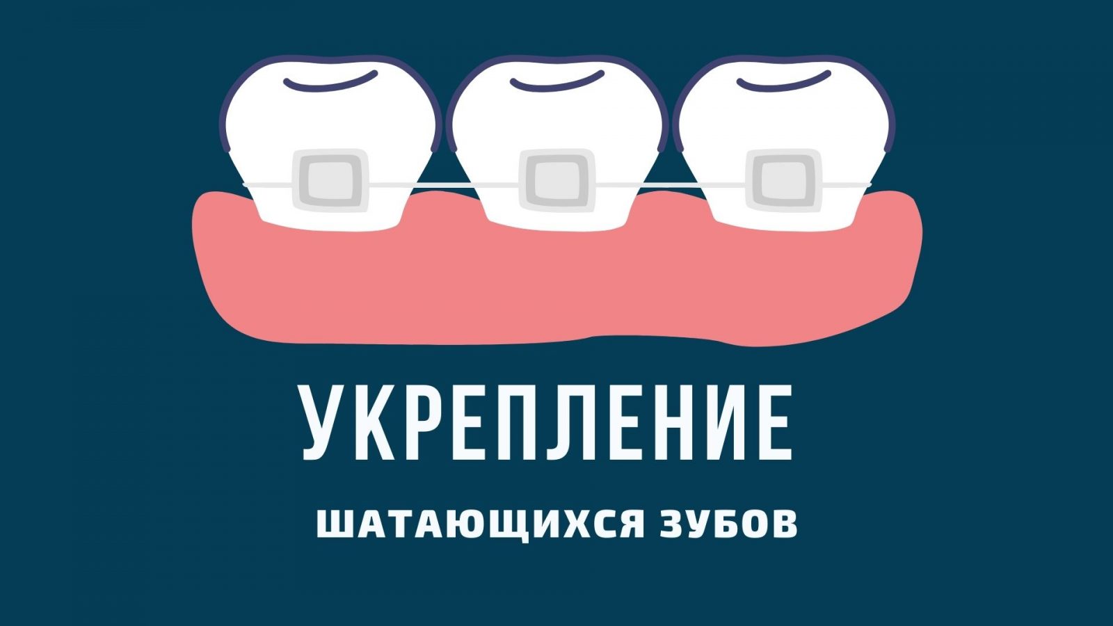 Чи можна самостійно зміцнити зуб, який хитається?