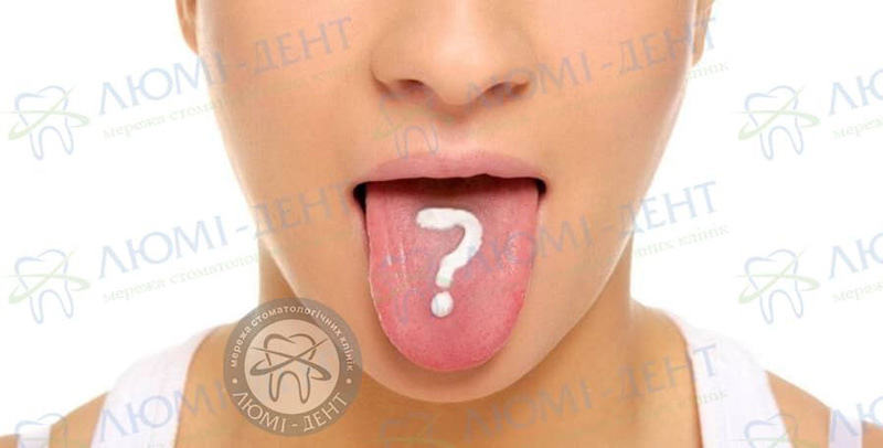 Причини оніміння язика