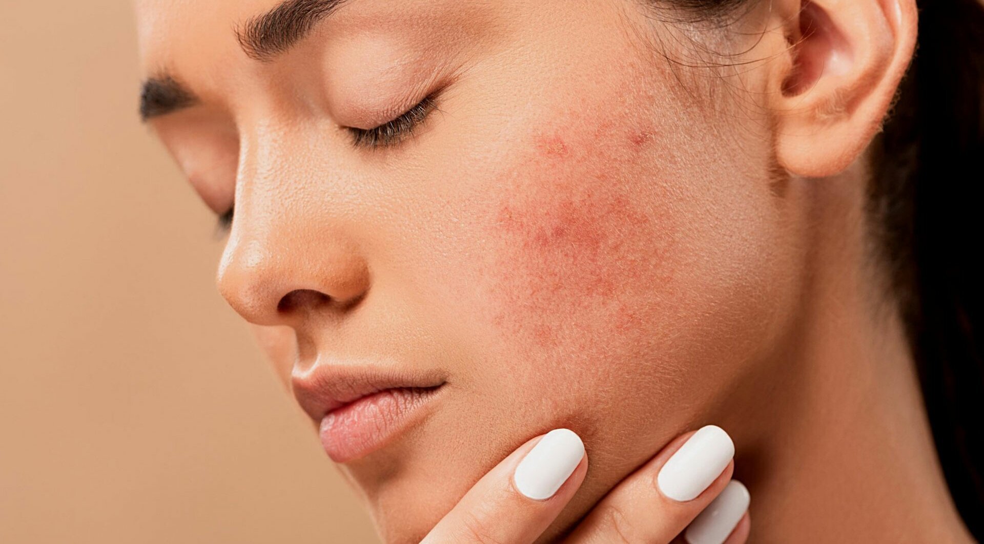 Алергічний висип на обличчі причини та методи лікування