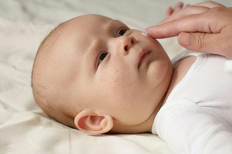 Як позбутися діатезу у немовлят на щоках